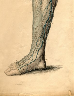 achilles-tendon5