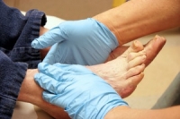 How Can Diabetic Patients Check the Soles of Their Feet?