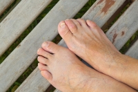 Causes of Hammertoes
