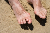 Impacts of Rheumatoid Arthritis on the Feet