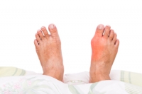 There May Be Numerous Causes of Gout